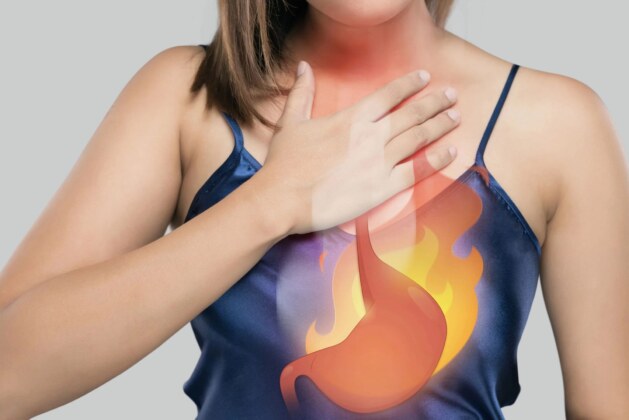 How to Get Rid of Heartburn