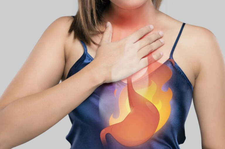 How to Get Rid of Heartburn