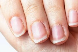 Why do your cuticles begin to peel and how to treat them