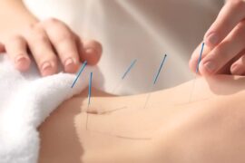 Here are some amazing benefits of acupuncture.  – Know how acupuncture can be beneficial for you.