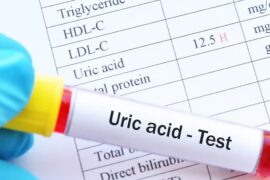 What is high uric acid and how you can control it.  Know what high uric acid is and how it can be controlled.