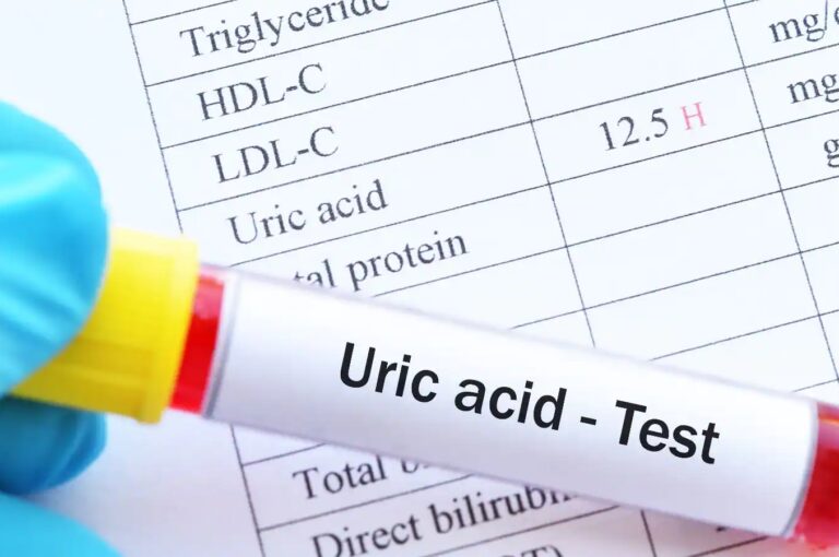 What is high uric acid and how you can control it. Know what high uric acid is and how it can be controlled.