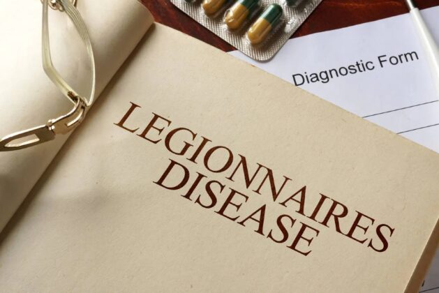 Legionnaires’ disease is the fourth victim in Argentina