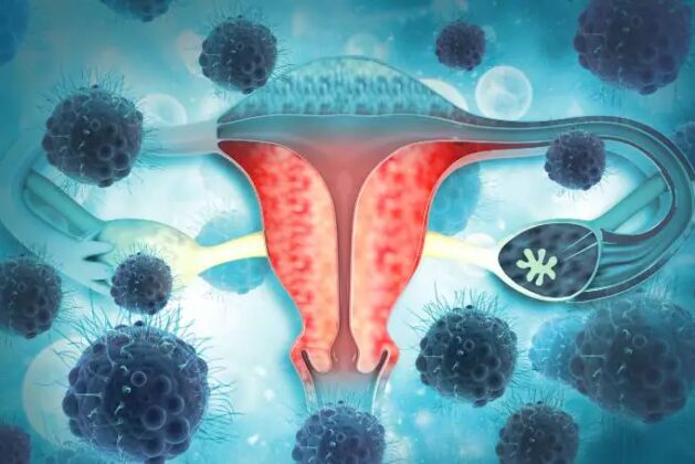 Know what gynecological cancer is and how to prevent it.