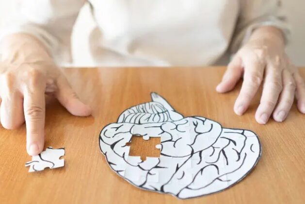 Know how you can handle dementia.- Know how you can handle dementia.