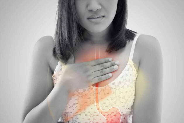 Learn how to stop heartburn and acid reflux.  Home Remedies to Prevent Acid Reflux and Reflux.