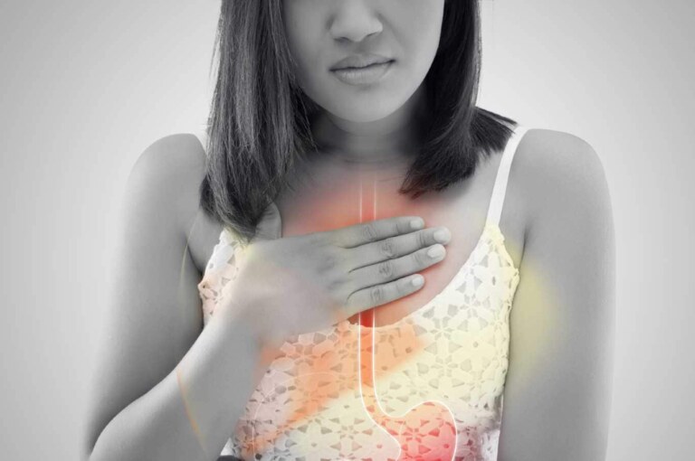 Learn how to stop heartburn and acid reflux.  Home Remedies to Prevent Acid Reflux and Reflux.