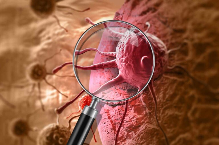 Know why the number of cancer cases is increasing in India.- Know why the number of cancer cases is increasing in India.