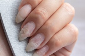 do you know why your nails often break?- Know why your nails often break and what the solution can be.