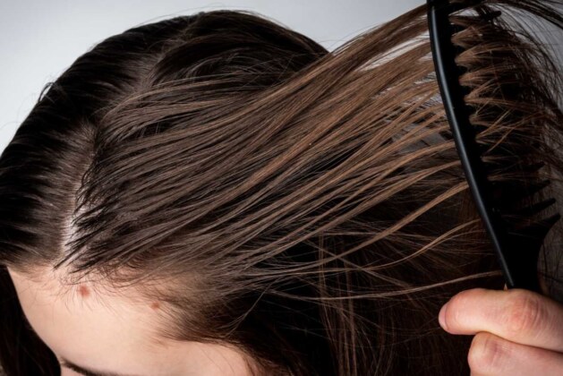 5 Home Remedies to Treat Oily Scalp These 5 natural ingredients can get rid of oily scalp.